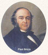 Paul Broca