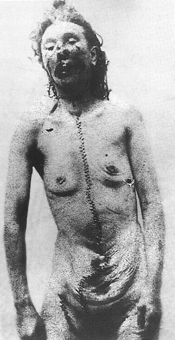 foto policial de la autopsia de Catherine Eddowes